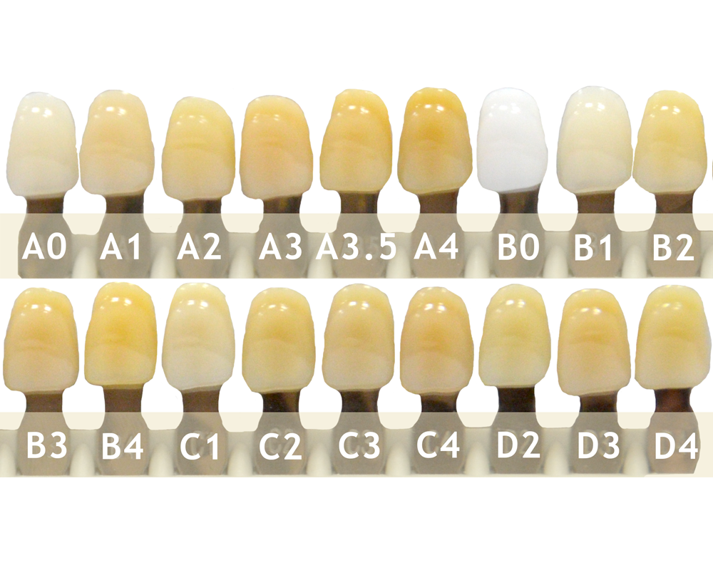 Палитра стоматология. Шкала Вита а2. Шкала Вита b1. Циркониевые коронки цвет а1, а2, а3. Металлокерамика коронки а1.