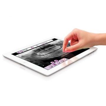 hyperion-x9,-myray