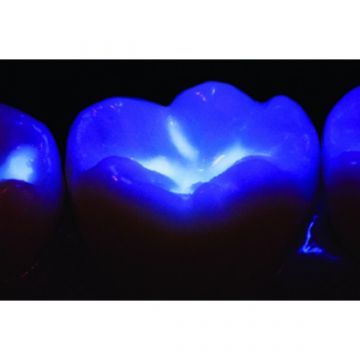 VALO-Blacklight - насадка 'блэклайт' для определения флуоресценции композитов