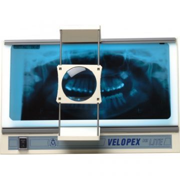 Velopex Hi Lite Viewer - стоматологический негатоскоп для интраоральных и панорамных рентгенограмм, с лупой